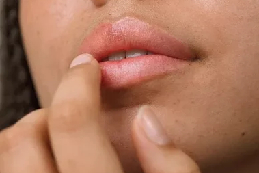 Dry lips